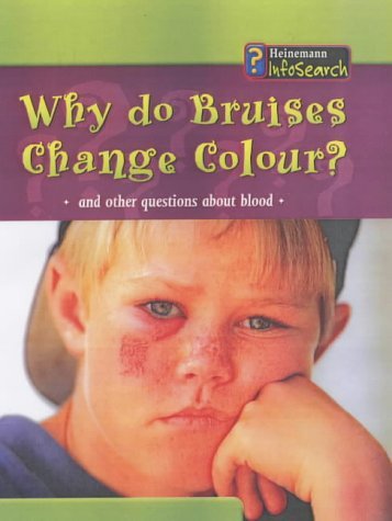 Book cover of Body Matters Why Do Bruises Change Colour Hardback by Angela Royston