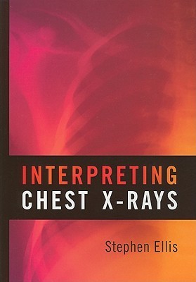 Book cover of Interpreting Chest X-Rays by Stephen Ellis