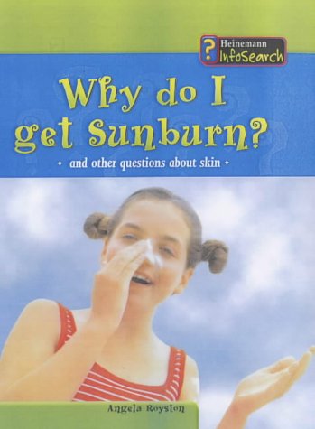 Book cover of Why Do I Get Sunburn? (Body Matters) by Angela Royston